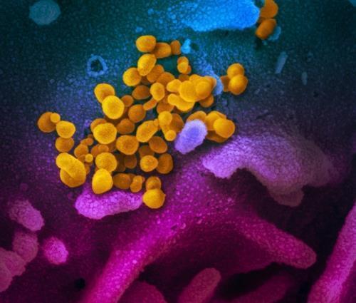 신종 코로나바이러스 신종 코로나바이러스(노란색)가 세포 표면(청색·분홍색)에 몰려 있다.   미국 확진자의 검체를 배양해 전자현미경으로 관찰한 것이다.  [미 NIH 국립 알레르기 감염병 연구소 제공/ 재판매 및 DB 금지]