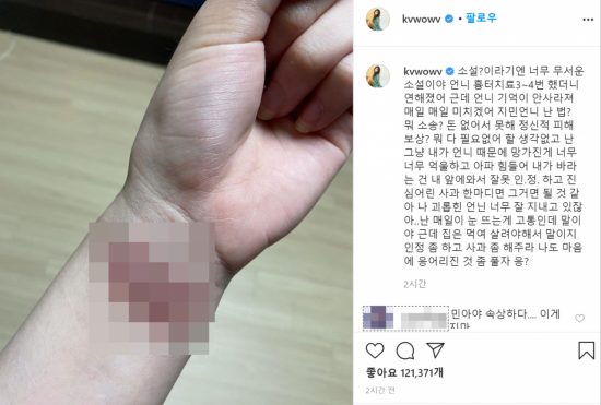 아이돌 그룹 AOA 출신 배우 권민아가 AOA 멤버 지민에게 괴롭힘을 당했다고 폭로하며 공개한 사진./사진=권민아 인스타그램 캡쳐