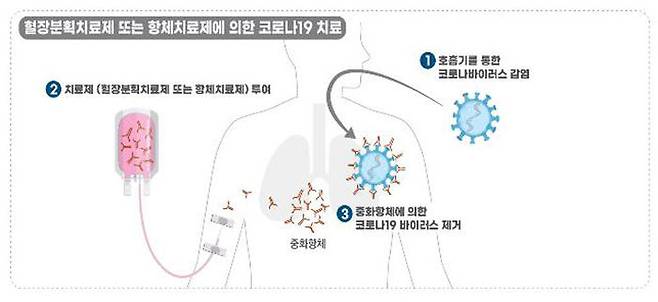 혈장치료제와 항체치료제에 의한 코로나19 치료