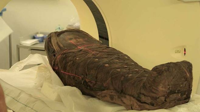 이집트 소년 미라 컴퓨터단층촬영(CT)