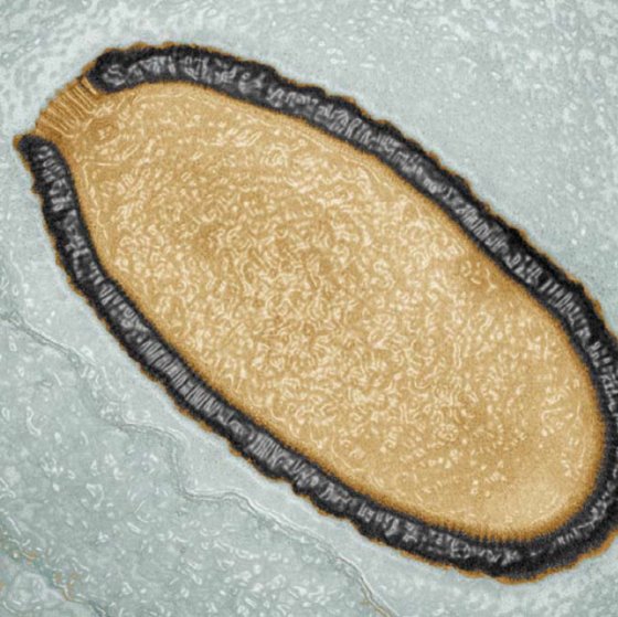 2014년 3만년 된 시베리아 영구동토에서 발견된 대형 바이러스(피토 바이러스). 사진 CNRS