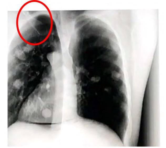 머디워터스가 조작 의혹을 제기한 나녹스의 방사선 사진/머디워터스
