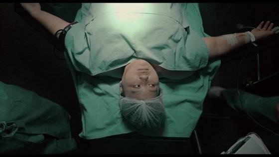 결국 비만대사 수술(위 절제술)을 선택한 장잉주안. 사진 영상 캡처