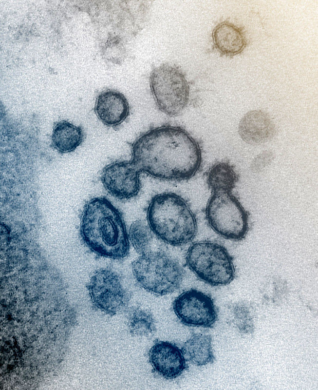 현미경으로 촬영한 코로나19 바이러스