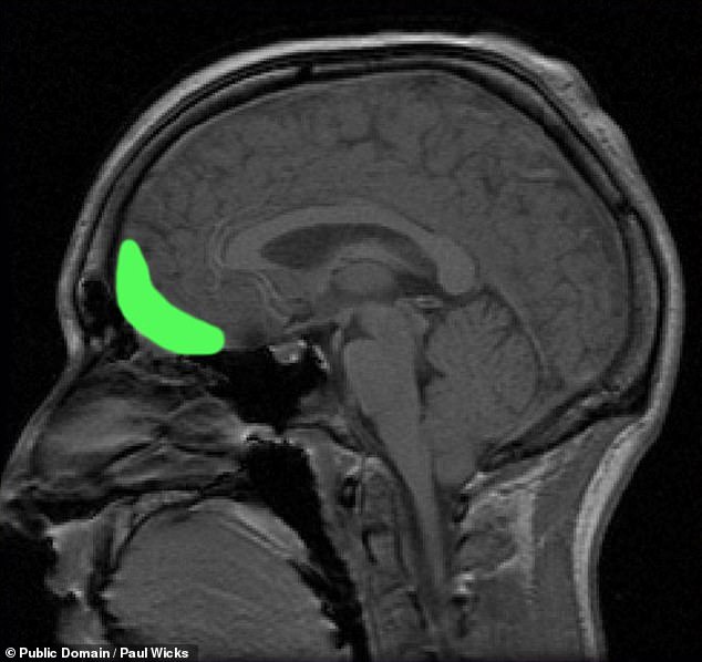 선택을 담당하는 안와전두피질의 위치를 나타낸 MRI 이미지.(사진=퍼블릭 도메인/폴 윅스)