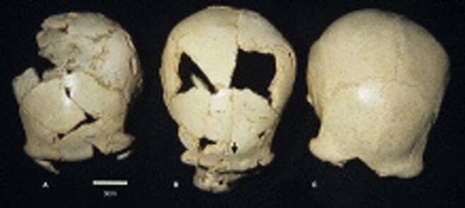 '시마 데 로스 우에소스'에서 발굴된 고인류 화석 [앙트로폴로지 논문 캡처. 재판매 및 DB 금지]