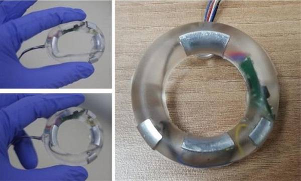 연구팀이 개발한 조산 예방용 전자약./KIST 제공