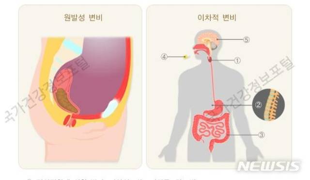 [서울=뉴시스] 변비의 발생 원인. (그림=질병관리청 국가건강정보포털 제공). 2021.01.08.