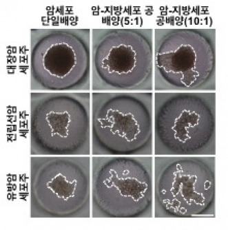 암세포(대장암, 전립선암, 유방암 세포주)를 지방세포와 함께 3차원 칩에서 공배양하면 암세포만 단일배양한 경우(왼쪽)와 달리 암세포들이 이동해 퍼져버리는 현상이 나타났다.  [서울대]