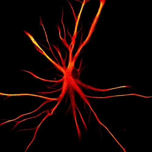 인간의 유도만능줄기세포(iPSCs)에서 유래한 성상교세포 [뉴욕 줄기세포 재단 연구소 제공 / 재판매 및 DB 금지]