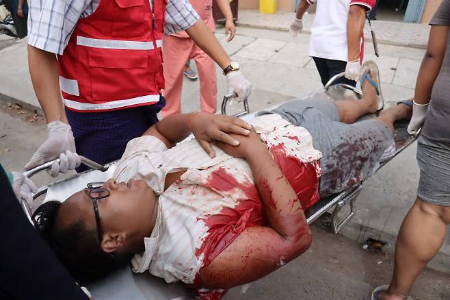 만달레이에서 열린 시위에 참여한 남성이 미얀마 군경의 시위 해산 과정에서 부상을 입었다(사진=AFP)