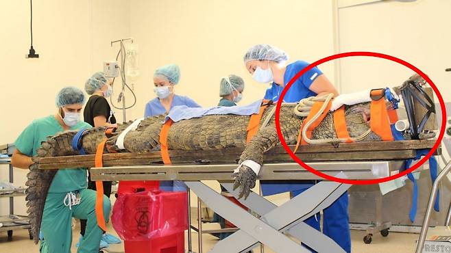 실수로 삼킨 관광객의 운동화를 위장에서 제거하기 위한 수술대에 오른 악어의 모습