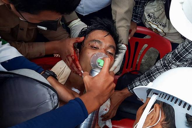 미얀마 남부도시 다웨이에서 28일 열린 반쿠데타 시위에 참여했다가 다쳐서 의료진의 치료를 받는 시민(사진=AFP)