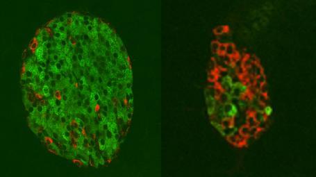 췌장의 랑게르한스섬 건강한 랑게르한스섬(좌)엔, 인슐린 생성 베타 세포(녹색)가 압도적으로 많고 글루카곤 생성 알파 세포(적색)는 얼마 되지 않는다.  반대로 당뇨병 환자의 랑게르한스섬(우)은 대부분 알파 세포로 뒤덮여 있다.  [UTSW 메디컬 센터 제공 / 재판매 및 DB 금지]