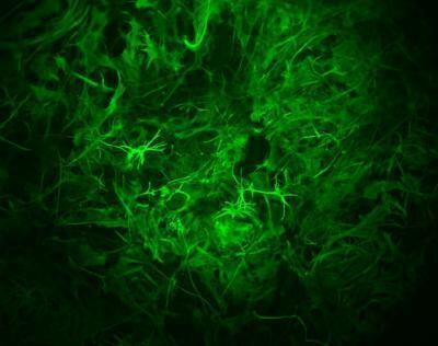 장기기억 형성에 관여하는 성상교세포(녹색) [미 소크 연구소 제공 / 재판매 및 DB 금지]