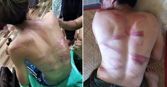 체포됐다 풀려난 15세 소년(왼쪽)의 모습. 미얀마 군경에 체포됐다 풀려난 남성들의 등에 시뻘건 상처가 나 있다. 트위터 캡처