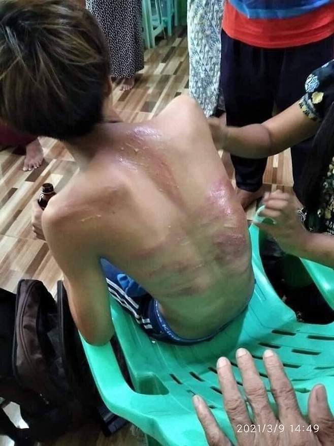 군경이 휘두른 쇠사슬에 맞은 15세 남성./사진=트위터(@KyisandarH)