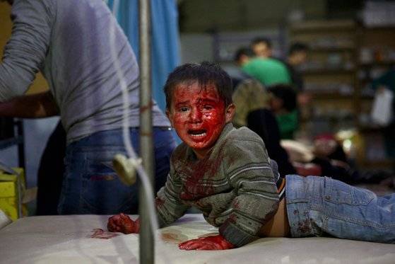 지난 2015년 10월 29일 시리아 수도 다마스쿠스 동쪽의 두마의 임시병원에서 정부군의 폭격으로 부상을 당한 어린이가 치료를 기다리고 있다. AFP=연합뉴스