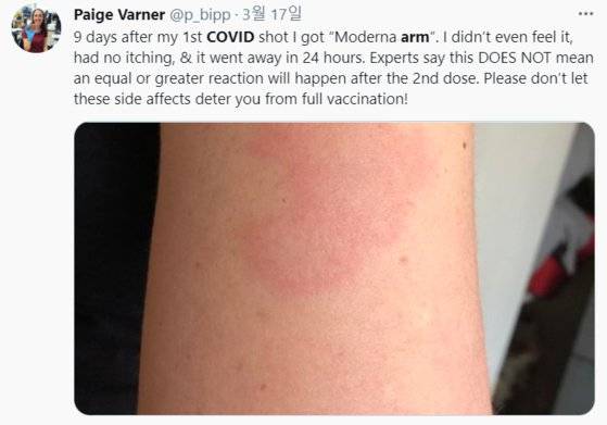 자신의 팔에 붉은 반점이 생긴 것을 인증한 트위터 사용자. [트위터]