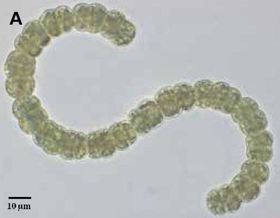 낙동강에서 채집된 남조류(시아노박테리아) 아나베나(Anabaena flos-aquae)의 광학 현미경 사진. 여름철 녹조 발생의 원인 생물이다. 사슬형태로 돼 있으며 사슬 중간에는 공기 중의 질소를 고정하는 역할을 맡고 있는 세포도 있다. [국립낙동강생물자원관]