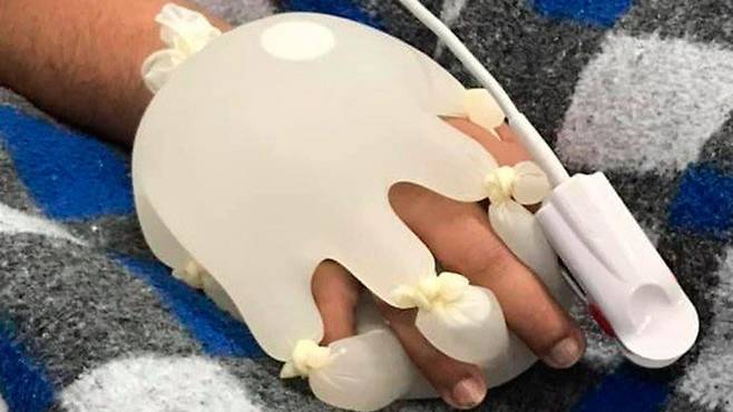 통증을 호소하며 손을 잡아달라고 부탁하는 코로나19 환자를 위해 브라질의 한 간호사가 발명한 ‘신의 손’