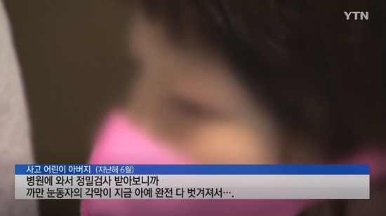 손 소독제가 눈에 들어가 각막에 화상을 입은 아이. 사진=YTN 뉴스 캡처