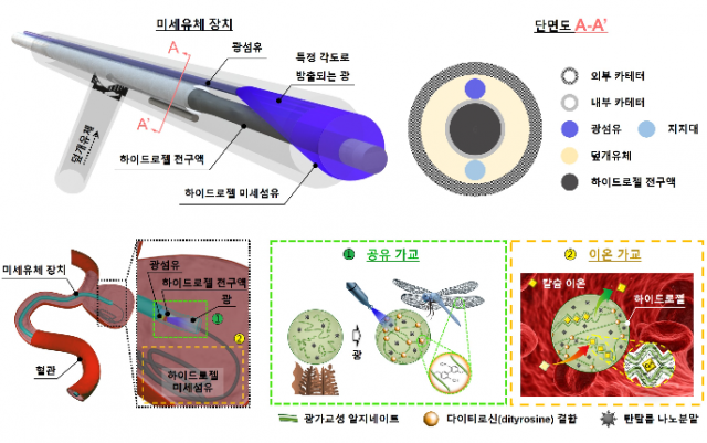 ▲포스텍이 발표한 머릿속 시한폭탄 '뇌동맥류' 새로운 치료법 ⓒ포스텍