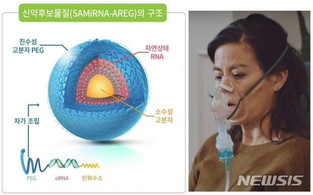 [서울=뉴시스] 바이오니아의 폐·신장 섬유증 등 치료 신약후보물질(SAMiRNA-AREG)이 상용화되면 장기·조직의 특성에 따라 주사제로 투여하거나 초음파 네뷸라이저로 흡입 치료할 수 있다. (그림= 바이오니아 제공, 사진= 미국폐협회(ALA) 네뷸라이저 사용법 동영상 캡처) 2021.04.13