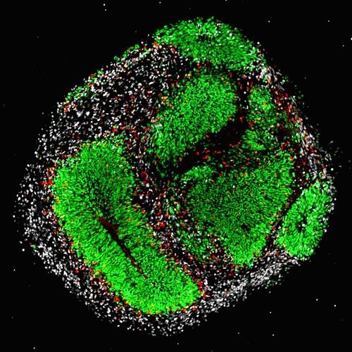신경줄기세포와 전구세포 인간의 배아줄기세포에서 배양한 뇌 오르가노이드.  신경줄기세포(녹색)와 전구세포(적색), 신경세포(백색) 등이 섞여 있다.  이런 뇌 오르가노이드는 인간 뇌의 초기 발달 과정을 연구하는 데 많이 쓰인다.  [스위스 취리히대 Daniel Gonzalez-Bohorquez 제공 / 재판매 및 DB 금지]