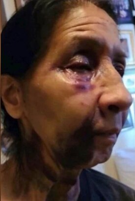 아시아계로 오인받아 버스에서 폭행당한 70세 멕시코계 여성. /인스타그램