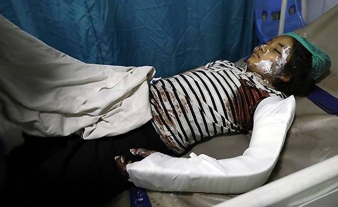 8일(현지 시각) 아프가니스탄 카불의 고등학교 교문 앞에서 발생한 차량 폭탄 테러로 다친 학생이 병원에서 치료받고 있다. 이번 테러 희생자 대부분은 여학생으로 알려졌다. /AP 연합뉴스