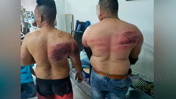 금식을 했다는 이유로 고용주에게 폭행 당한 두 경호원의 사진.