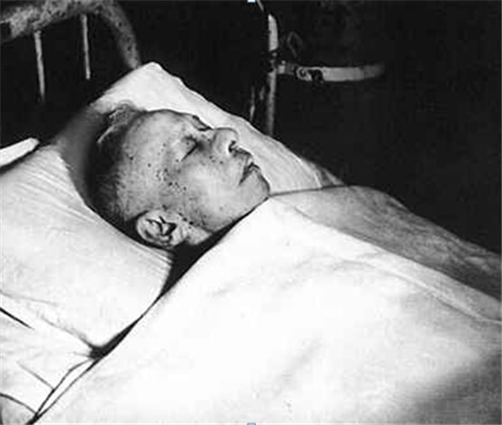 <1967년 11월 12일 카이펑시 혁명위원회 건물에 실려와 감금 상태에서 사망한 류샤오치의 마지막 모습/ 공공부문>