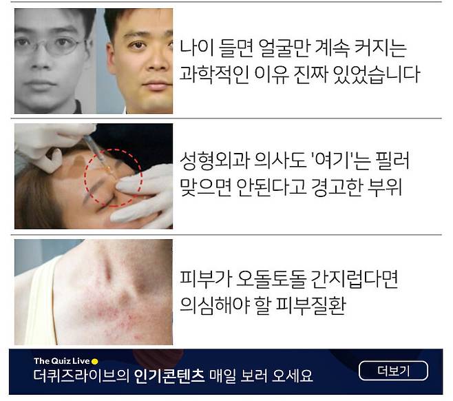 몸무게 그대로인데 턱살만 자꾸 찌고 있다면 의심해야할 병 | 더 퀴즈 라이브