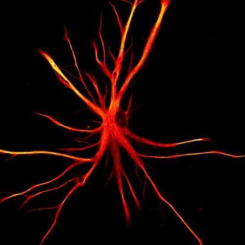 수면 조절에도 관여하는 성상교세포 뇌에서 흔히 발견되는 성상교세포(astrocytes)는 수면의 양과 질을 제어하는 데 중요한 역할을 하는 것으로 알려졌다.  사진은 인간의 유도만능줄기세포(iPSCs)에서 유래한 성상교세포.  [뉴욕 줄기세포 재단 연구소 제공 / 재판매 및 DB 금지]