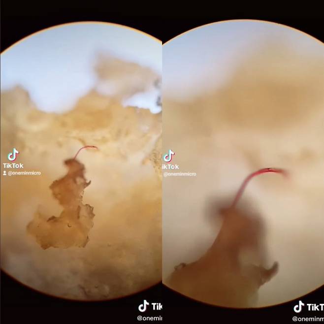 흔히 먹는 냉동 생선살에 미세 플라스틱 조각이 박혀 있는 모습이 공개돼 충격을 주고 있다. /사진='oneminmicro' 틱톡 캡처