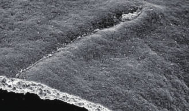 닭의 원시선을 주사전자현미경으로 촬영한 모습이다. 기존 생명윤리 가이드라인은 배아 연구를 수정 후 14일 이내까지만 허용했다. 이는 뇌와 척수가 분리되는 원시신경관 윤곽인 원시선이 생기는 것을 생명의 징표로 삼은 결정이었다. K. Tosney 제공