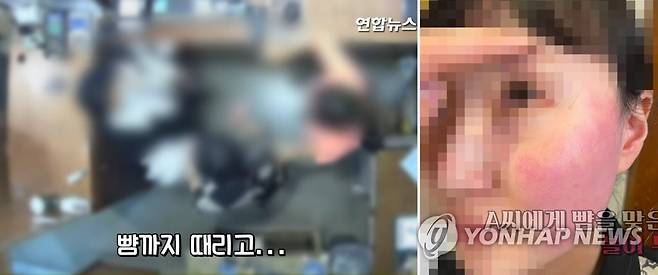 옷가게 점원 폭행하는 대사부인 CCTV 공개 (서울=연합뉴스) 폭행 혐의로 경찰 조사를 받고 있는 주한 벨기에 대사 부인에게 뺨을 맞은 피해자인 옷가게 점원과 가족이 볼이 부은 사진과 폭행 당시 CCTV 영상을 20일 공개했다. 2021.4.20 [연합뉴스 TV 캡처] photo@yna.co.kr