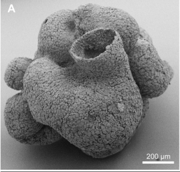 6억 년 전 인산염암에서 발견된 해면 화석의 현미경 사진. 보존 상태가 꽤 좋다. 미국국립과학원회보 제공