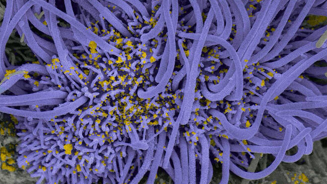 호흡기 섬모세포에 침투한 코로나19 바이러스(노란색). 파스퇴르연구소 제공