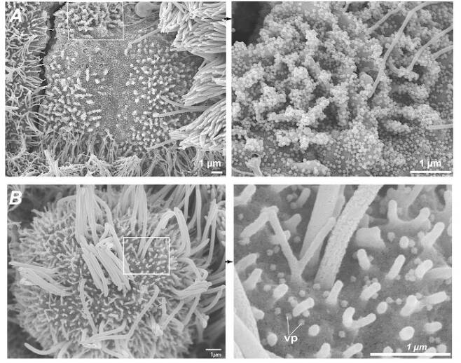 바이러스가 잘라낸 섬모 가닥(왼쪽). 오른쪽은 네모 부위를 확대한 사진. 네이처 커뮤니케이션스