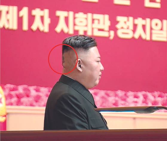 Another photograph of Kim's side profile shows a dark area where the bandage had previously been. [KCNA]