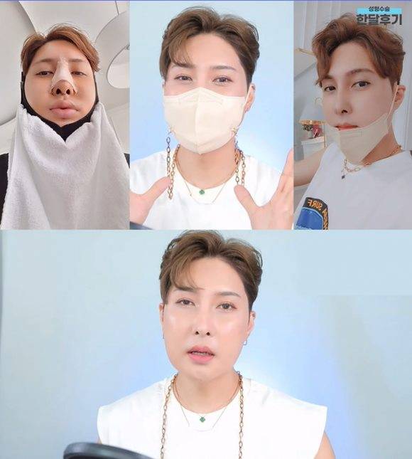 뷰티크리에이터로 활동 중인 김기수가 성형수술 후기를 공개했다. /유튜브 채널 화면 캡처