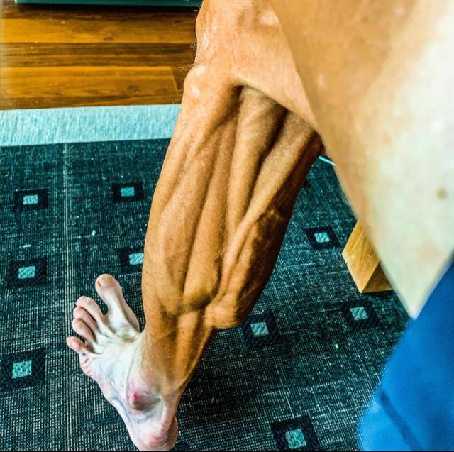 연습 후 근육이 도드라진 슬로베니아의 야니 브라코비치 다리. 브라코비치 페이스북