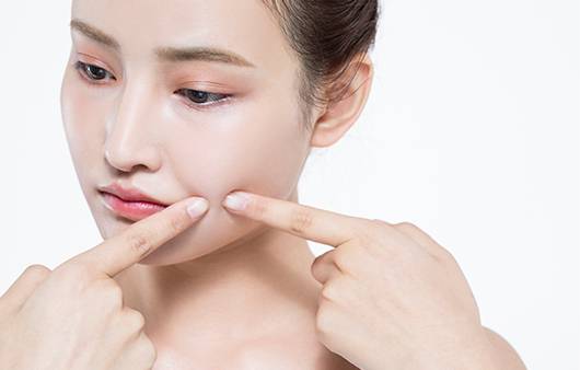 모낭염은 여드름과 다른 질환으로, 세균 감염이 주 원인이다