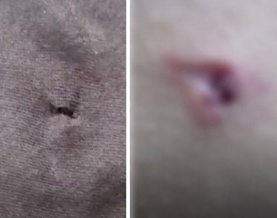 4일 경북 예천군의 한 중학교 양궁부에서 선배의 화살을 맞은 후배 선수의 옷(왼쪽) 상태와 등에 난 상처. KBS제공