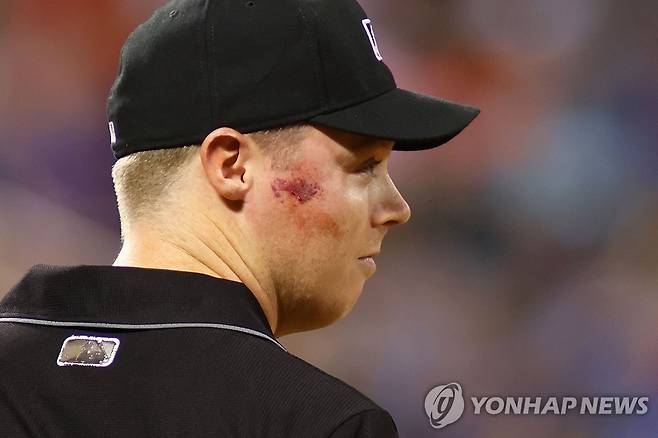 얼굴에 핏자국이 선명한 1루심 주니어 밸런타인 [AFP=연합뉴스]