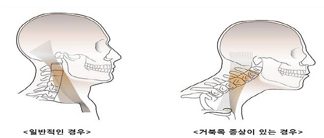 (자료= 건강보험심사평가원)