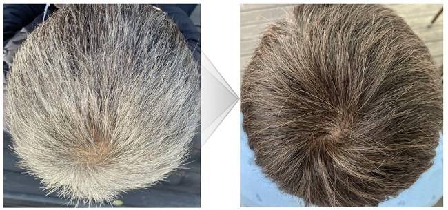 모다모다 샴푸를 4주 사용한 50대 남성의 모습 [사진출처 : 모다모다 샴푸 제품 소개서]