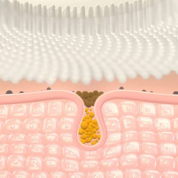 LG프라엘 워시팝 모공청소 (사진=LG전자)